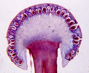 Claviceps purpurea Mutterkorn Pilz, Parasitär an Getreide