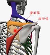 肩のこり、トリガーポイント