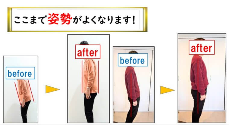 施術後、ここまで姿勢改善します