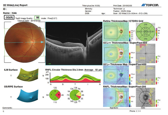test eye 3d ganteimedical ç¼åºã«ã¡ã©ã¬ã³ã¿ã«ã® OCTè£ç½®ã®å¯è½æ§ã«ã¤ãã¦