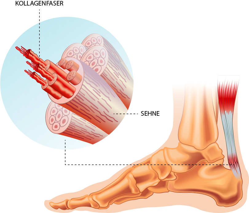 Sehnentherapie & Arthrosetherapie Dr. med. Matthias Marquardt