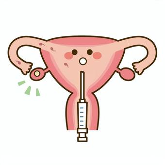 人工授精
