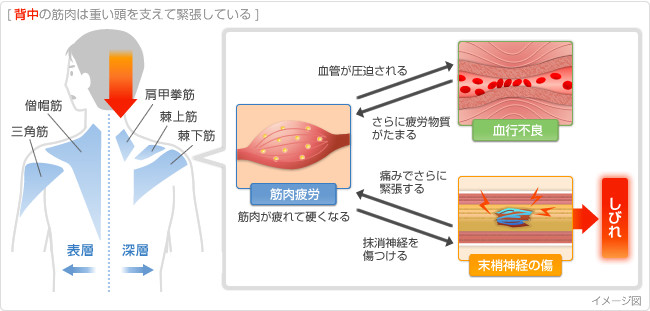 肩こりがどうやってなるのかの図解