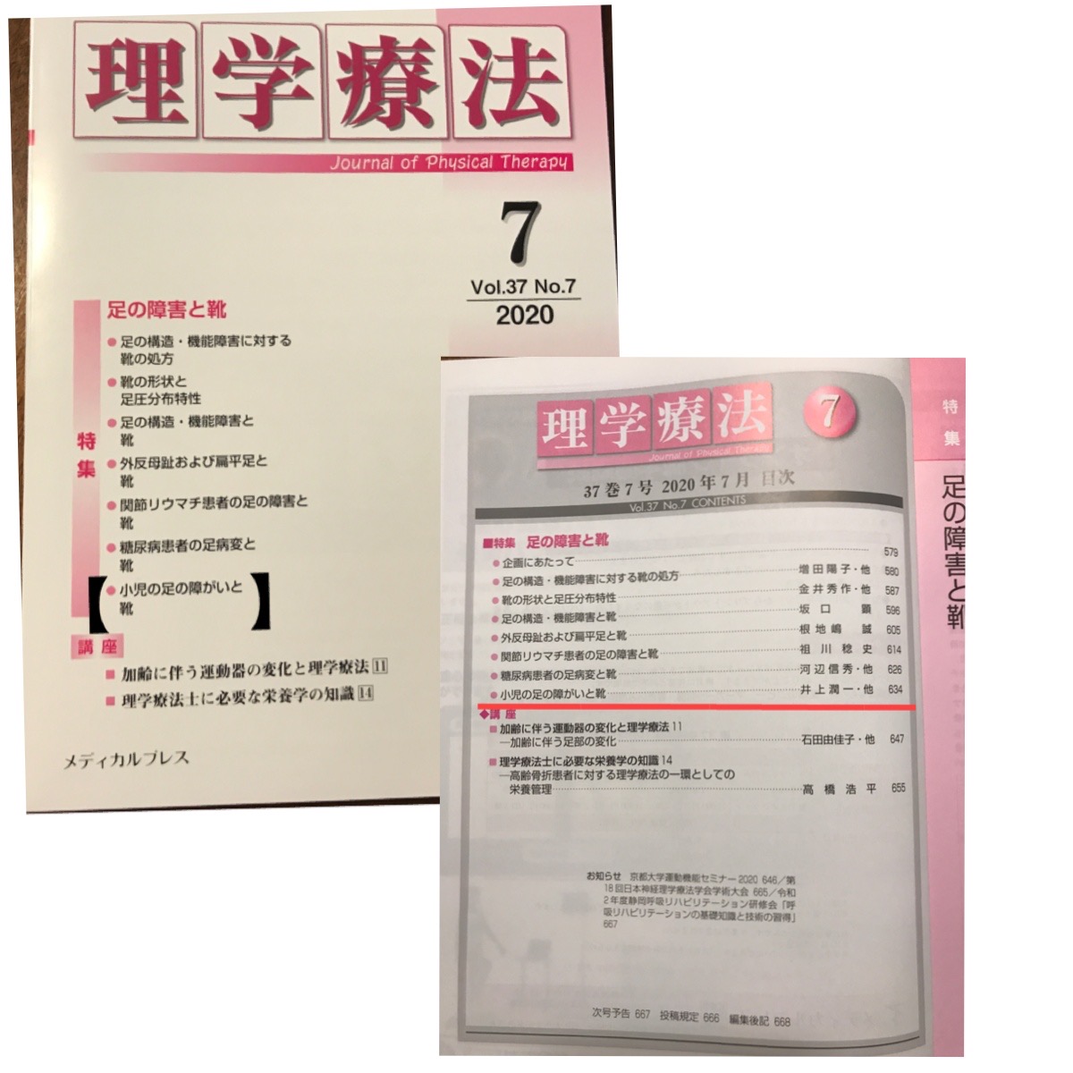 オーダーメイドインソール（入谷式足底板療法） - 鳥取市の足