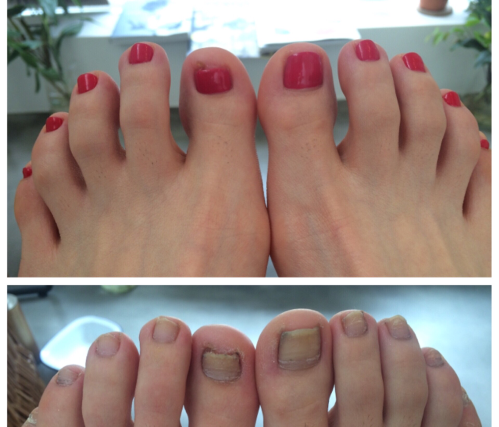 Foot Gel Omvag Reflexology Nail Salon Ookayama