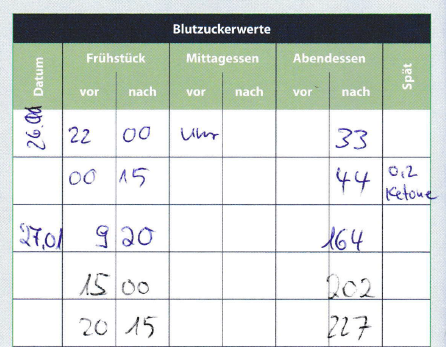 Bild: Blutzuckerwerte