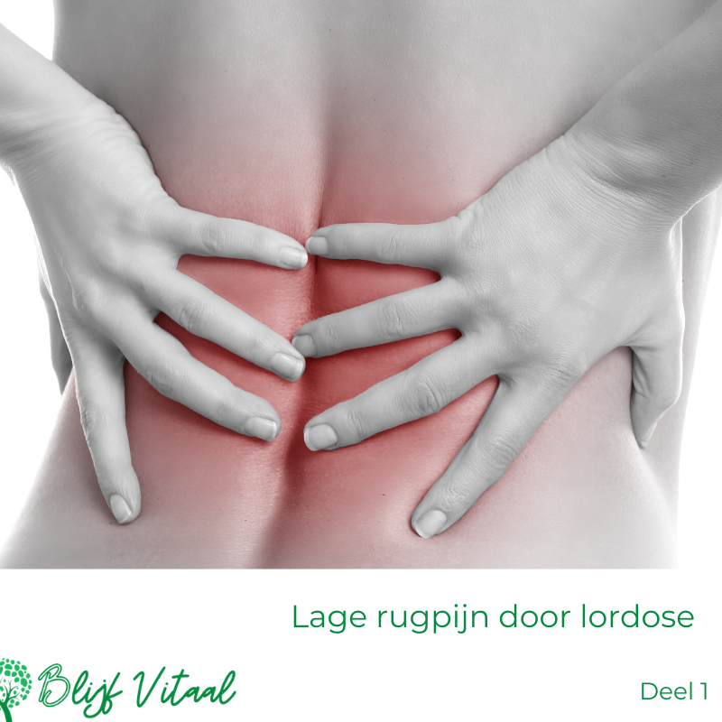 Blog 43: Heb jij lage rugpijn door een te holle rug (lordose)?