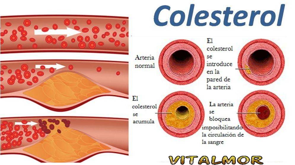 #moringa controla el Colesterol?