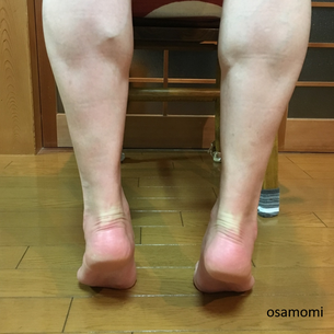 ふくらはぎの筋力アップが後脛骨筋炎の予防改善。昭島市のオサモミ整体院