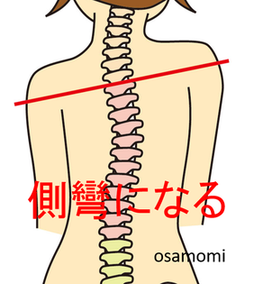 外反母趾は側弯症も伴ってくる。昭島市のオサモミ整体院