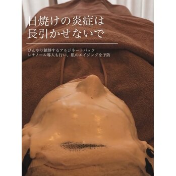 うっかり焼け、してしまったら