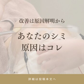 シミ対策は原因探しから始めよう