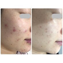 同じ場所に繰り返しできていませんか？