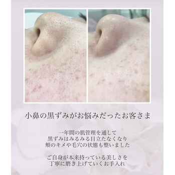 一年の肌管理を経て…