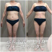 痩身で叶える体重減プラスα