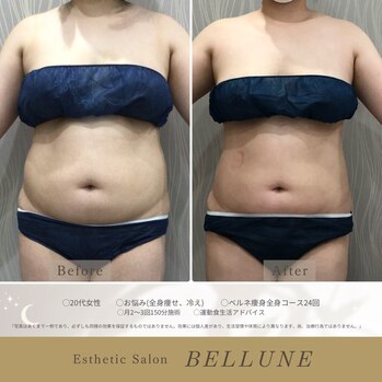 半袖に抵抗感？ダイエットを始めたいあなたへ