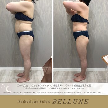 「もう遅い？」40代からのダイエット