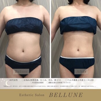 知っておいてほしい！肥満と病気の関係性