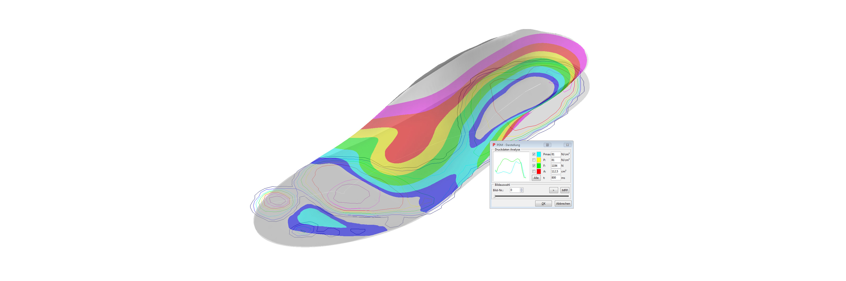 Insole design pedcad foot technology GmbH