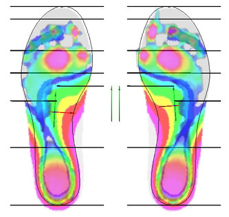 Superimposed representation of dynamic pressure measurement and insert with line proportion