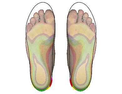 2D-measurement and selected insole shown overlapped