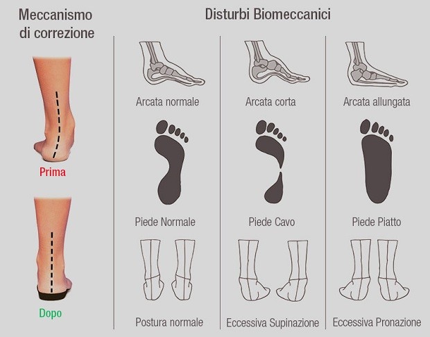 Pronatore o cheap supinatore consumo scarpe