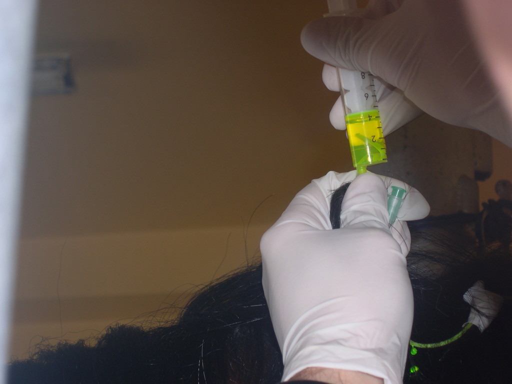 Test fluoresceina