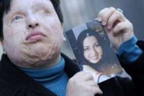 Der international aufsehenerregende Fall Ameneh Bahramis hat ein humanes Ende gefunden. Die 32-jährige Iranerin erblindete, nachdem ihr ehemaliger Kommilitone Madschid Mowahedi 2004 ein Säurenat