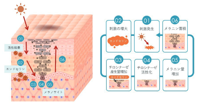 シミができるメカニズム