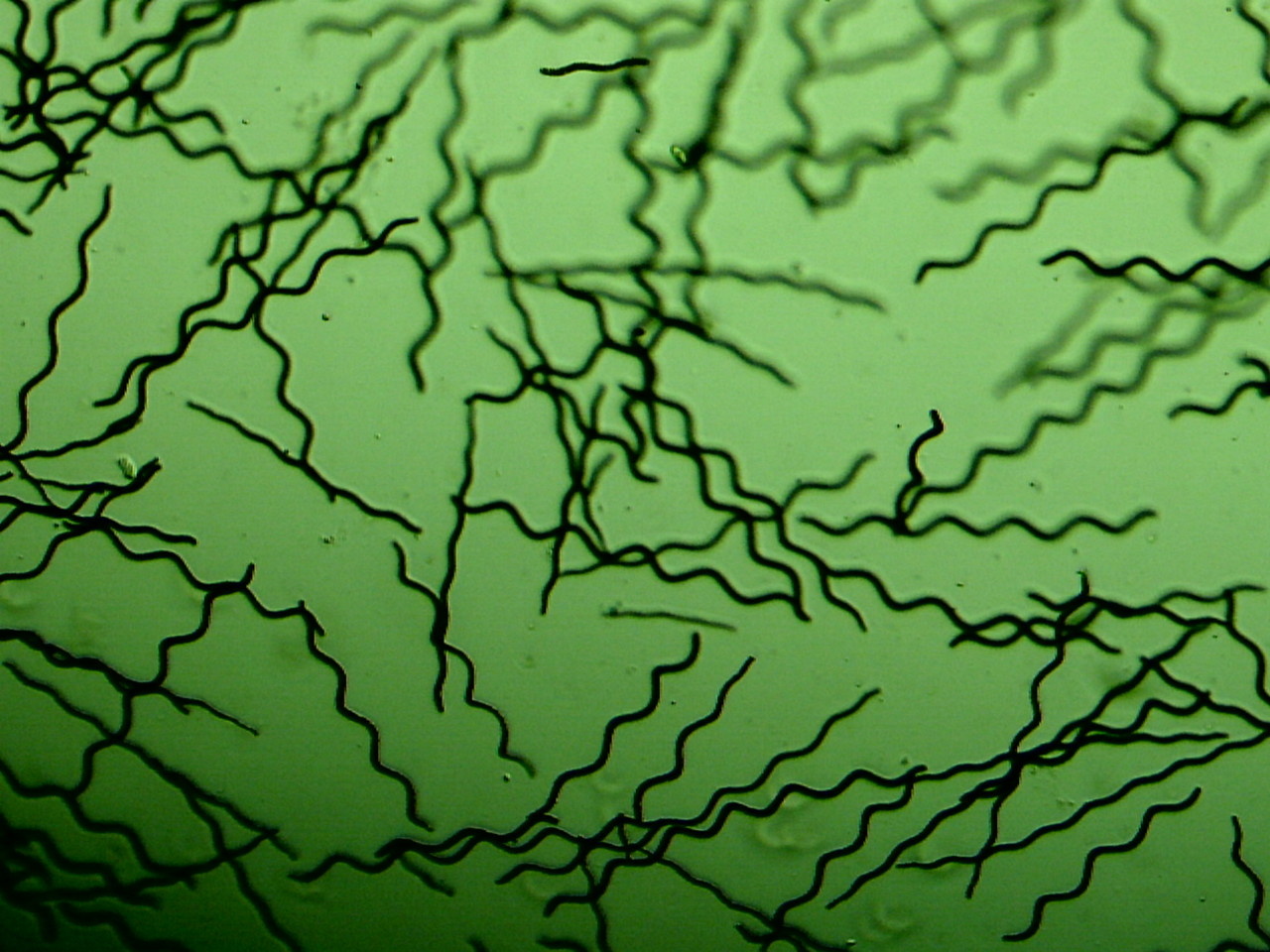 La Spiruline Spiruline du moulin Alsace