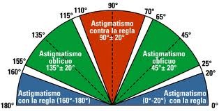 Classificazione dell'astigmatismo secondo la posizione del meridiano o asse.