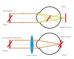 Ottica geometrica dell'astimatismo.