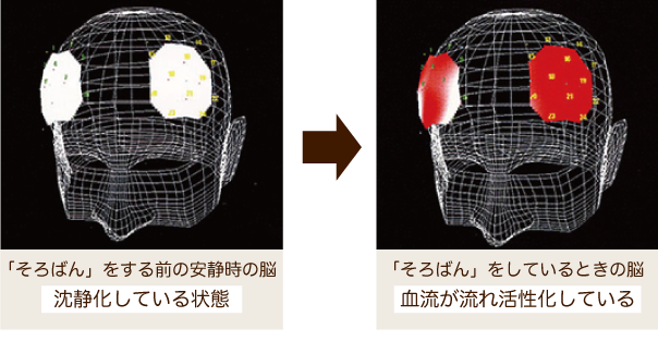 そろばんをする前の安静時の脳からそろばんをしている時の脳の血流が活性化している写真