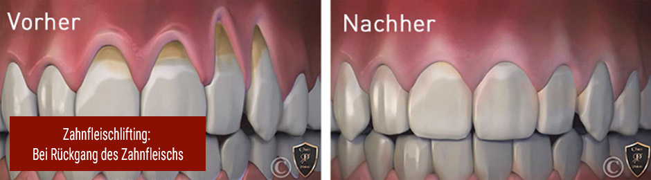 Zahnarzt Frankfurt Niederrad Dr S Rassaf