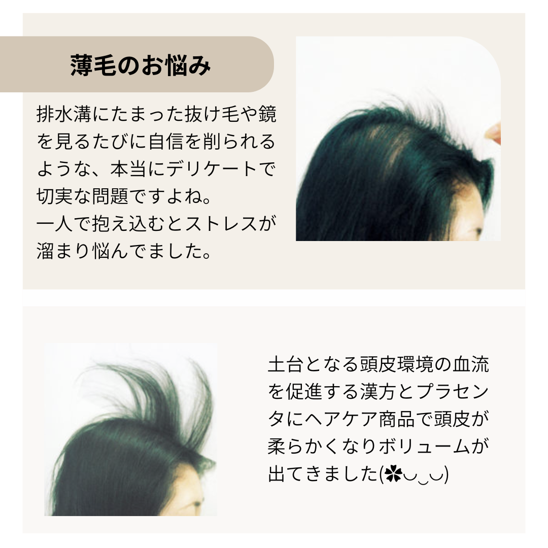 抜け毛はストレスや食事のサイン