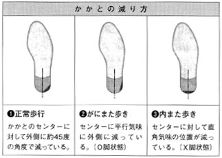 履く靴の底の減り方