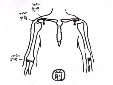 subacromial_bursitis_f.JPG (20290 バイト)