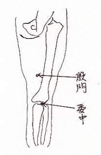 swelling_of_the_leg2.jpg (10863 バイト)