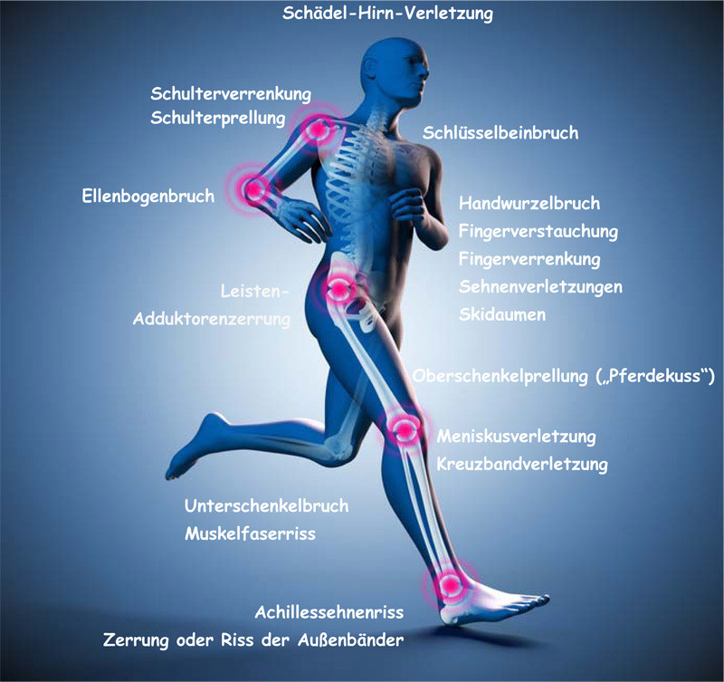Spezialist für Sportverletzungen - Orthopädie Feibel