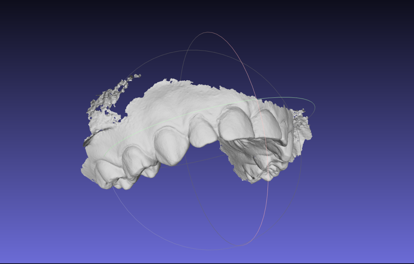 impronta digitale dei denti