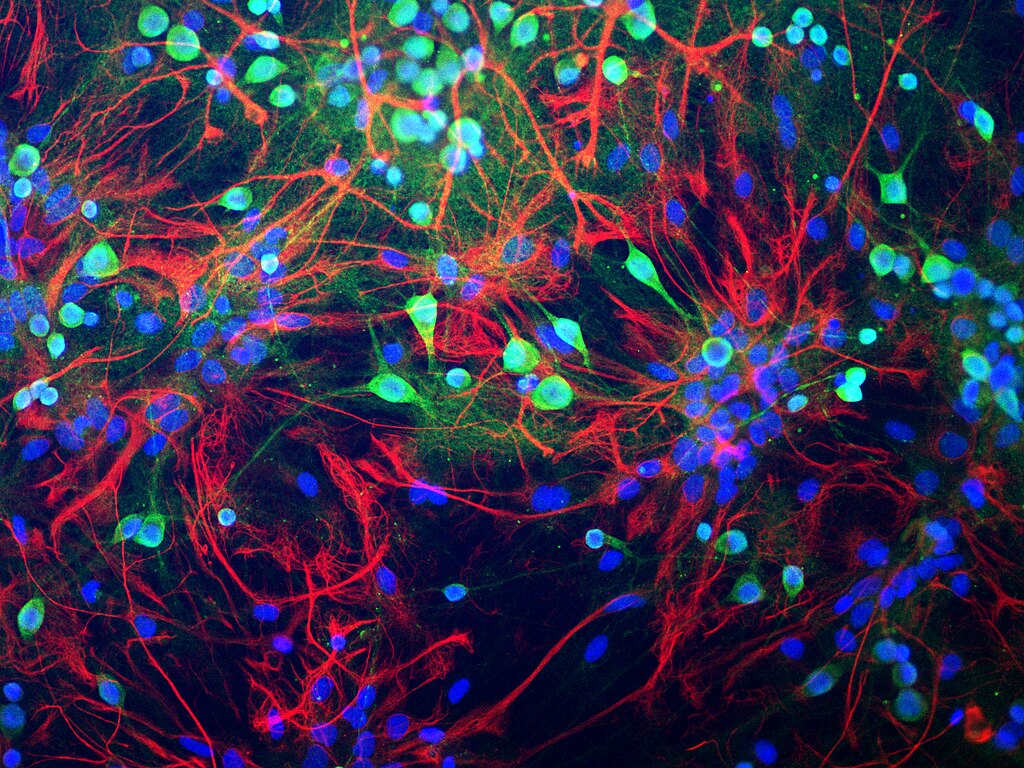 Neuronen, Synapsen und Neuroplastizität – Das Gehirn erklärt