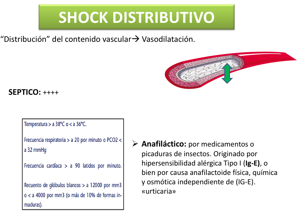 Shock Distributivo Página web de pseudomonas
