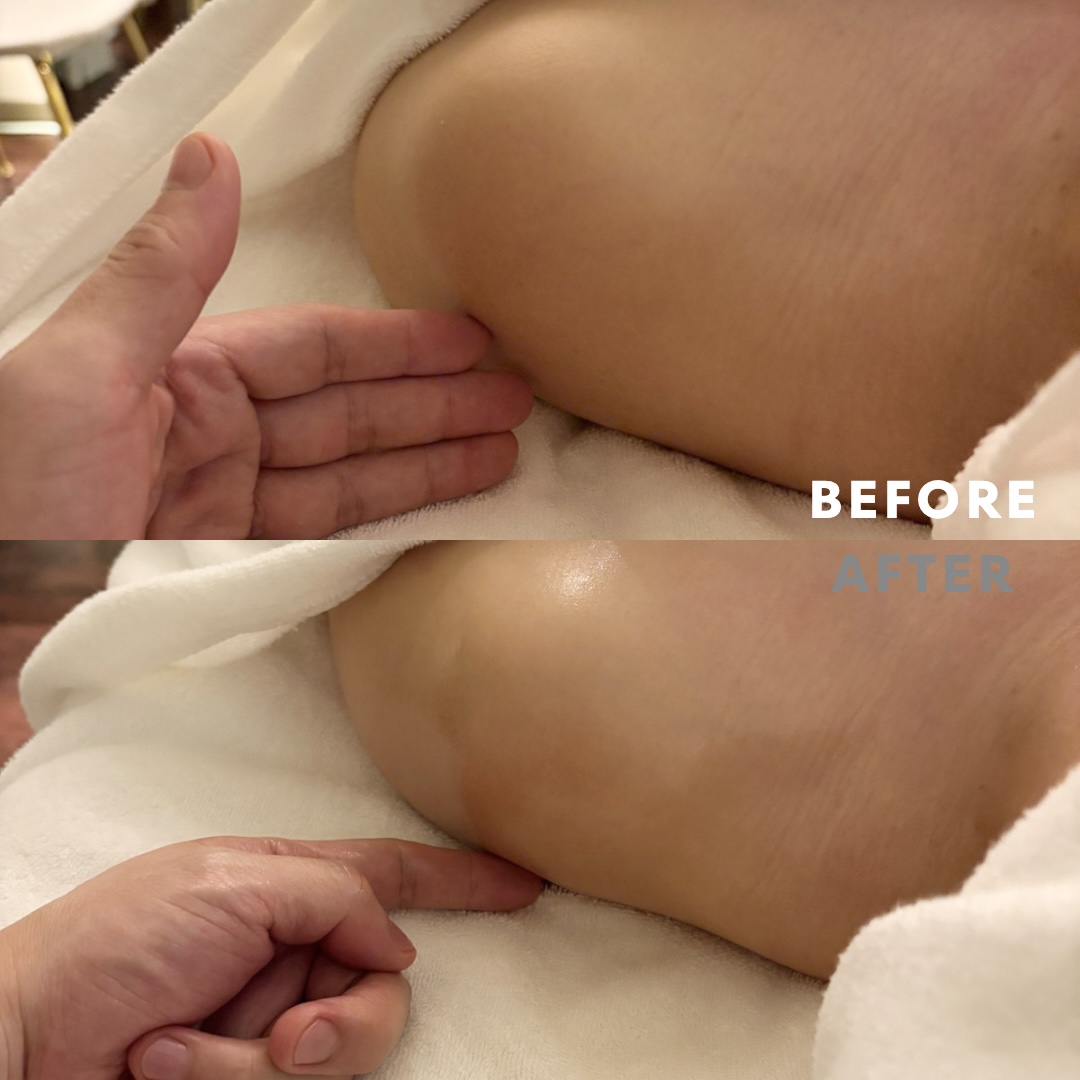 巻き肩リンパマッサージモニター⑧様