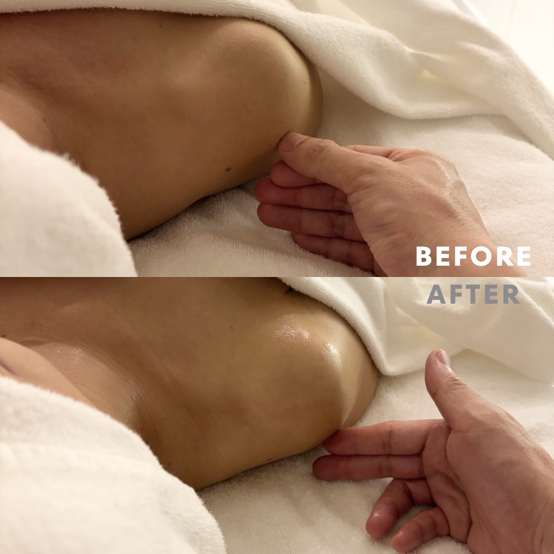 巻き肩リンパマッサージモニター⑤様