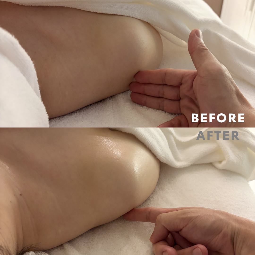 巻き肩リンパマッサージモニター⑨様