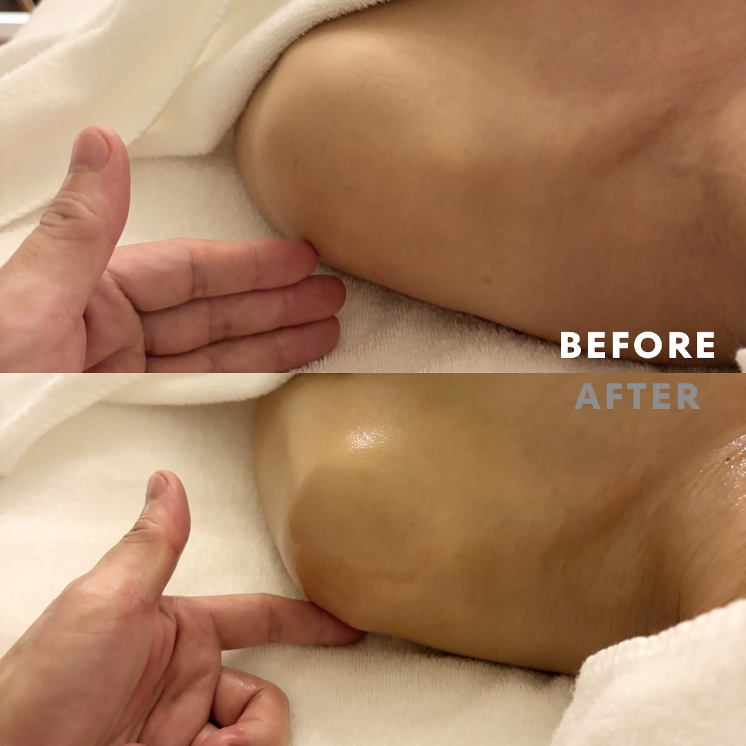 巻き肩リンパマッサージモニター⑤様