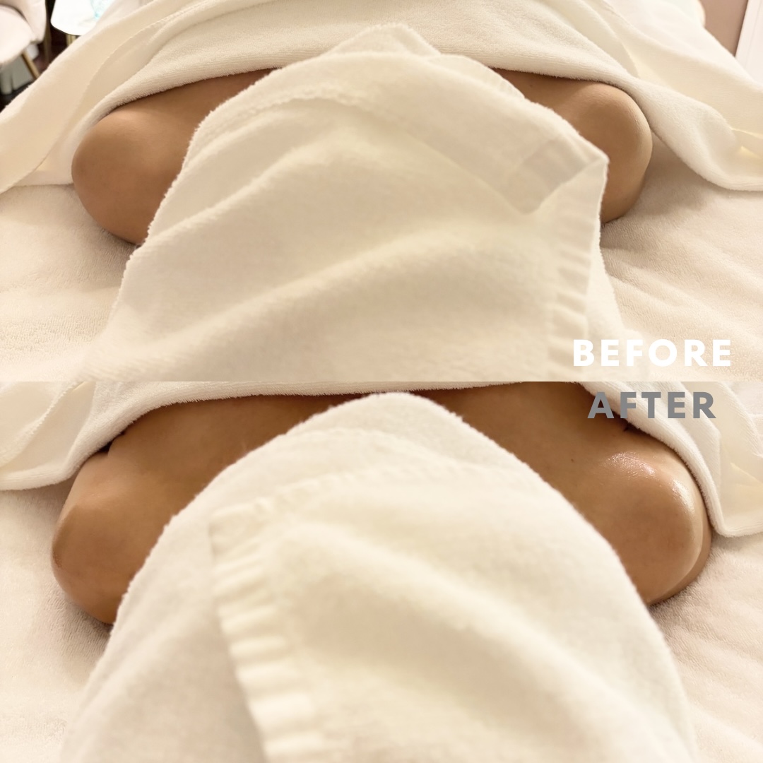 巻き肩リンパマッサージモニター⑤様