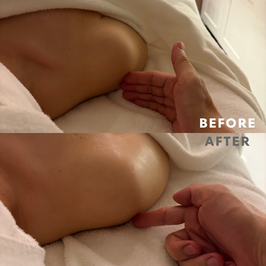 巻き肩リンパマッサージモニター②様