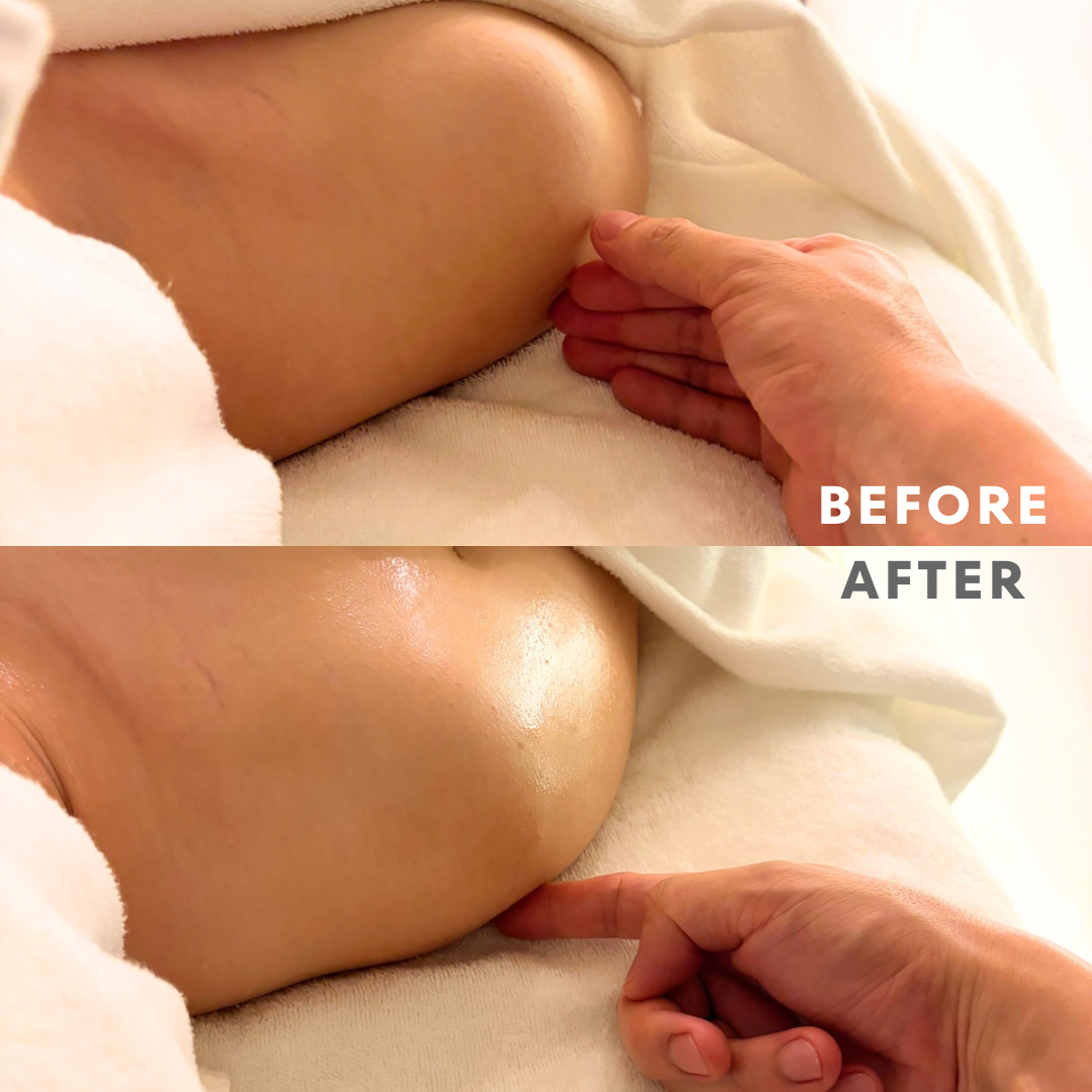 巻き肩リンパマッサージモニター③様