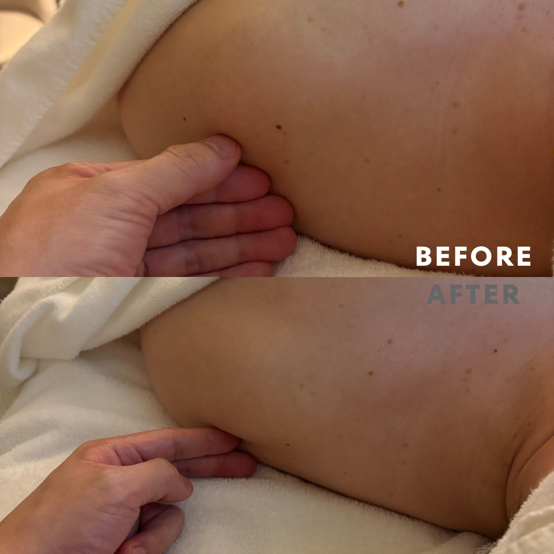 巻き肩リンパマッサージモニター⑥様